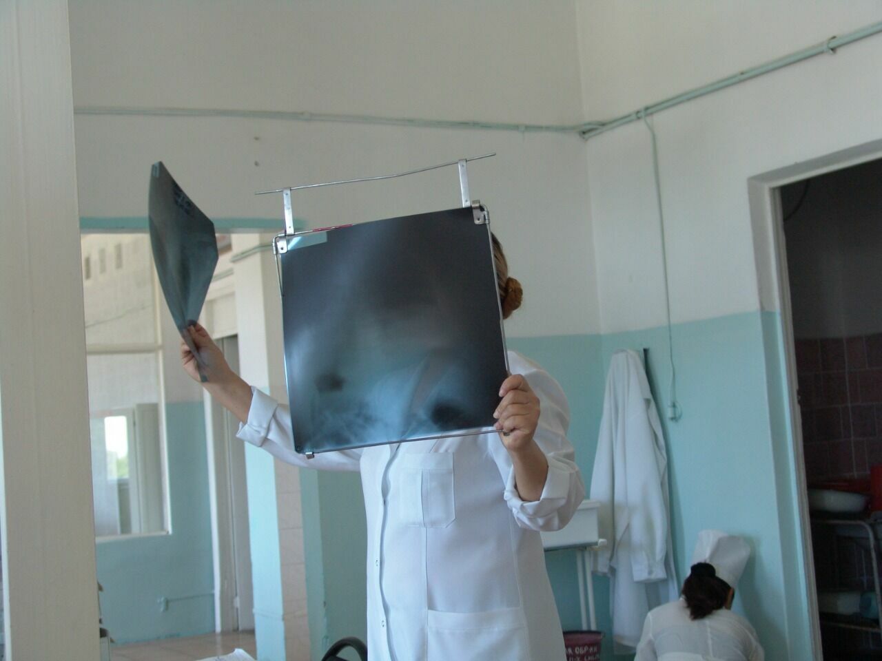 Рост заболеваемости туберкулезом отмечается в Мангистау