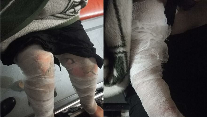 Пятеро человек из них двое детей пострадали в загоревшемся авто в Павлодаре