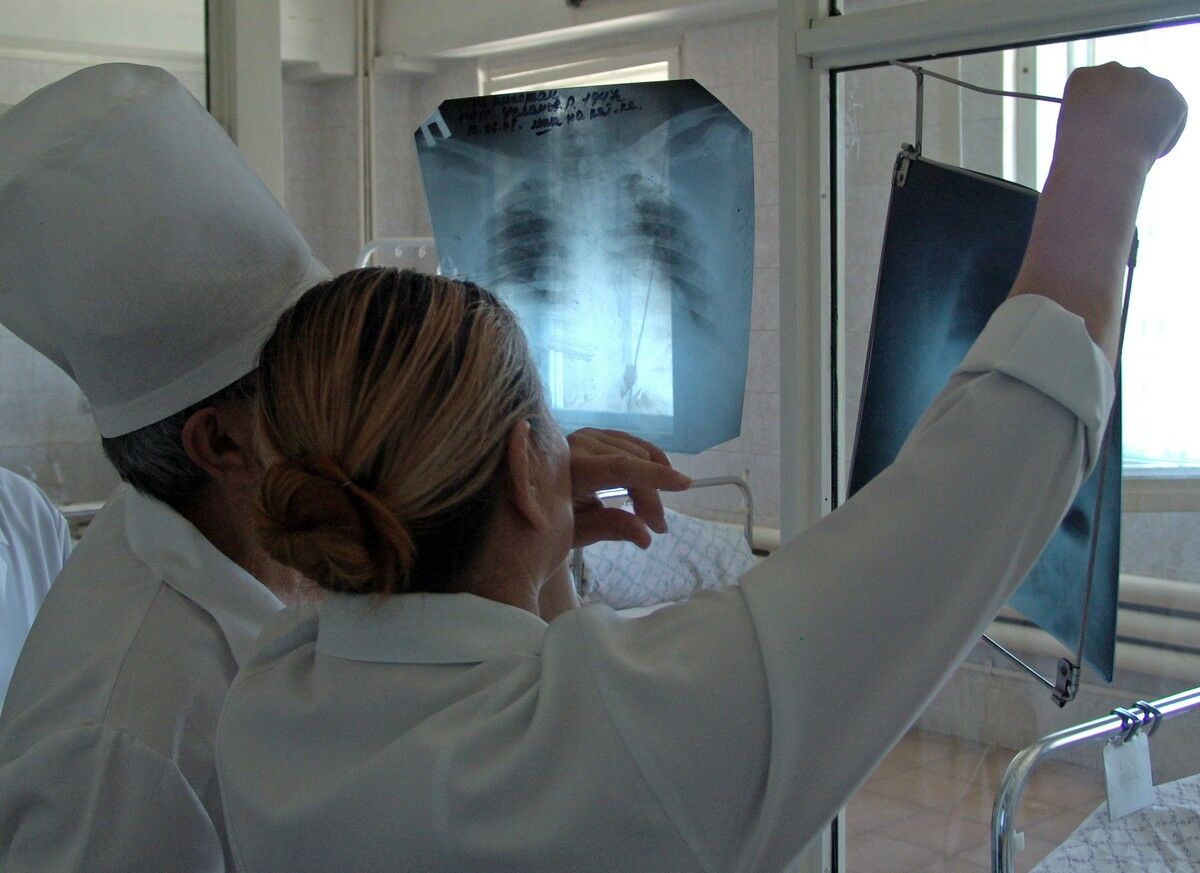 Минус 75 процентов