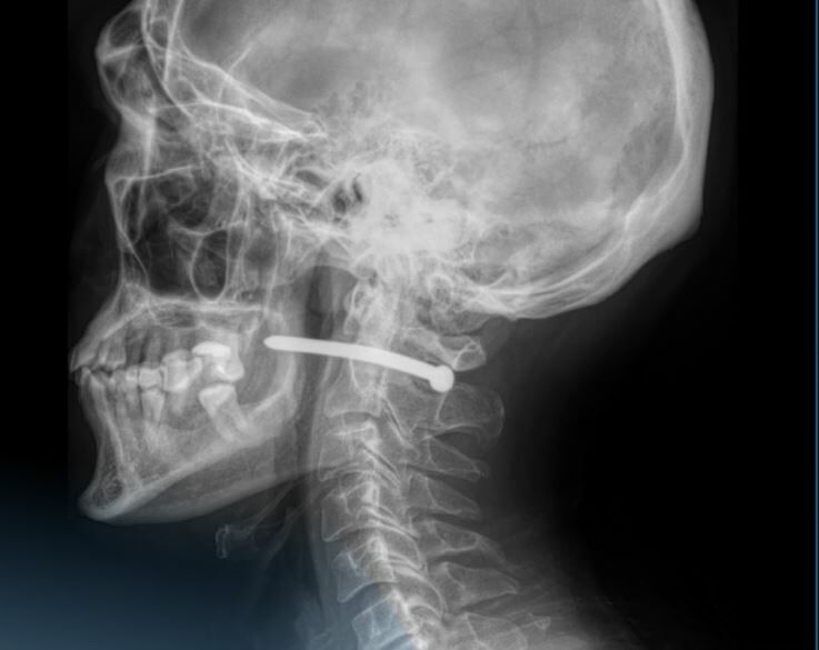 Выстрел в голову