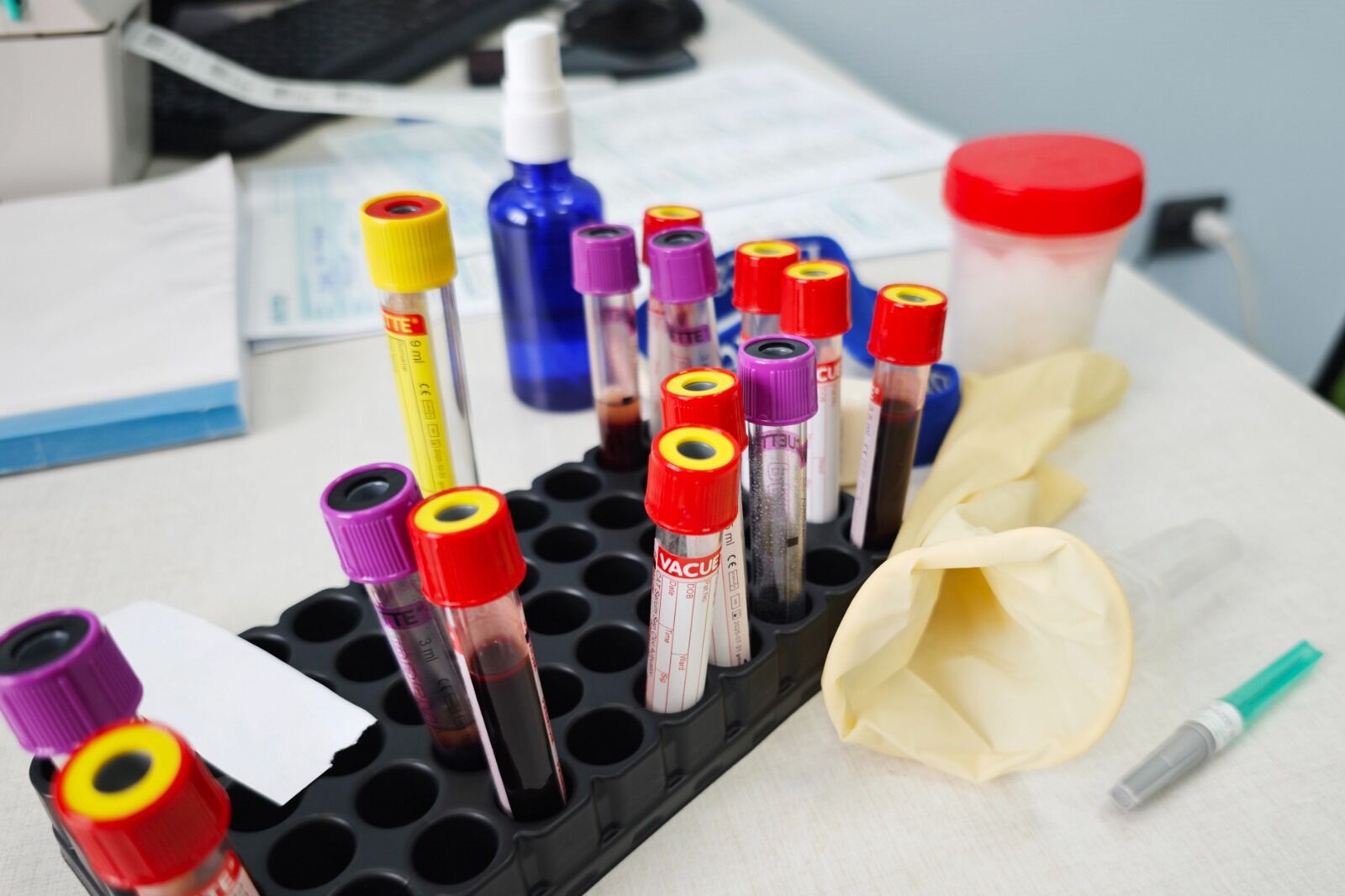 Научились выявлять или просто прошляпили?