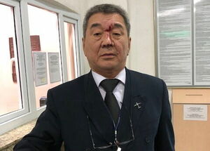 Результат - на лице