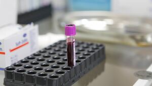 Под контролем НОК