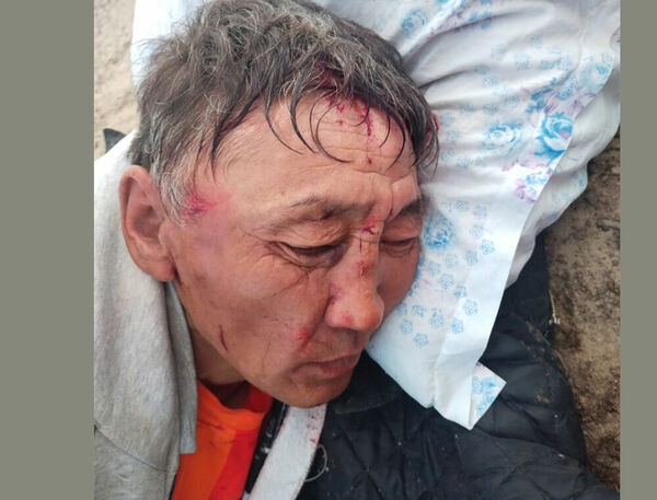 Увечья вместо денег