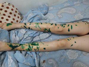 Страшный оскал бешеного пса