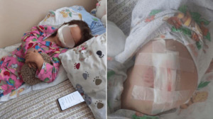 Семилетняя девочка госпитализирована после нападения двух алабаев близ Алматы