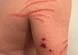 Нападение исподтишка