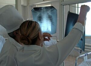 Минус 75 процентов