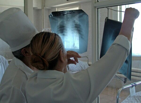 Минус 75 процентов