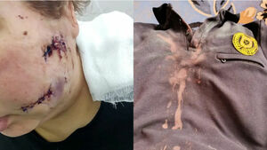 Нервный должник