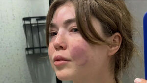 Прощать нельзя!