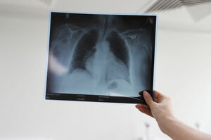 Стоп заразе