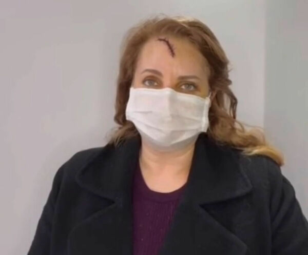 Убрать свидетеля?