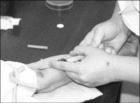 “Шприц-криг”: плюсы и минусы