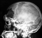 Стрельба на поражение