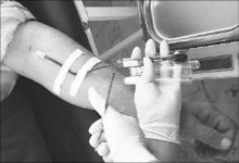 Матери детей, больных гепатитом C: Мы не дождались от министра искренности