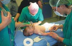 Сердечная достаточность