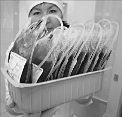 Жаксылык ДОСКАЛИЕВ, министр здравоохранения РК: вопросы - не ко мне