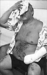 Телефонные страдания