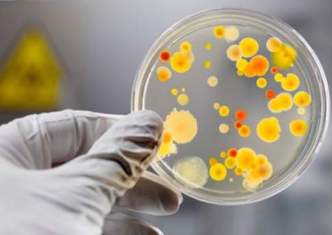 У 18 госпитализированных с подозрением на отравление мороженым в Шымкенте обнаружен сальмонеллез