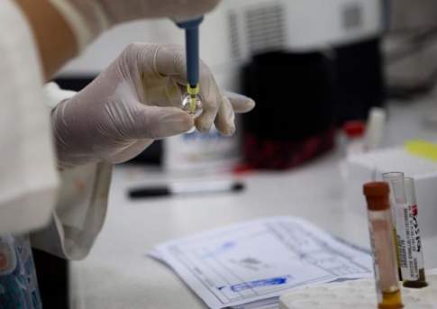 11 человек госпитализированы с подозрением на сибирскую язву в Кыргызстане