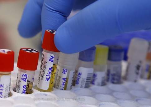 Информации о завозе вируса Коксаки из Турции в Казахстан нет – минздрав