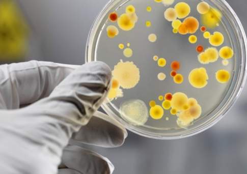 Сальмонеллёз выявили у отравившихся бургерами в Уральске