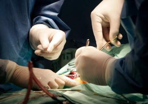 Свыше 4 тысяч казахстанцев нуждаются в пересадке органов