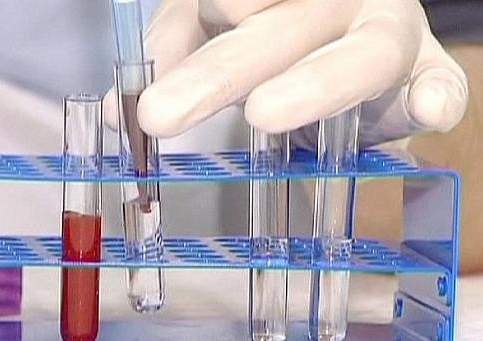 За чистый спорт